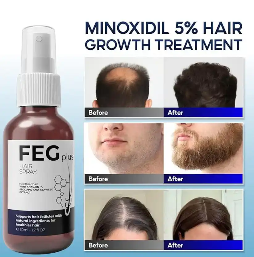 Buy 1 Get 1 Free Offer | FEG Plus Hair Growth Spray – Best Hair Regrowth Solution