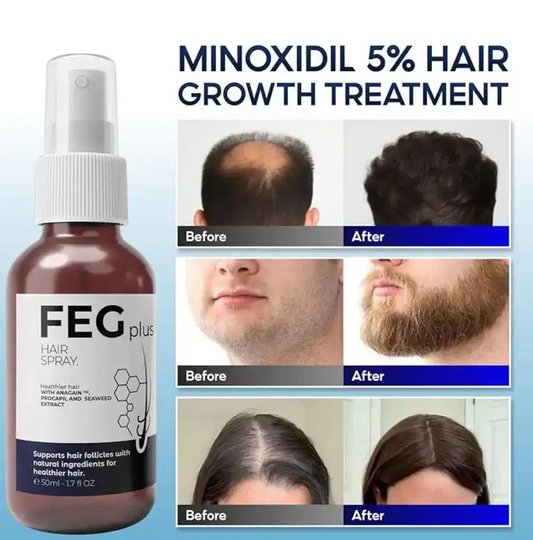 Buy 1 Get 1 Free Offer | FEG Plus Hair Growth Spray – Best Hair Regrowth Solution